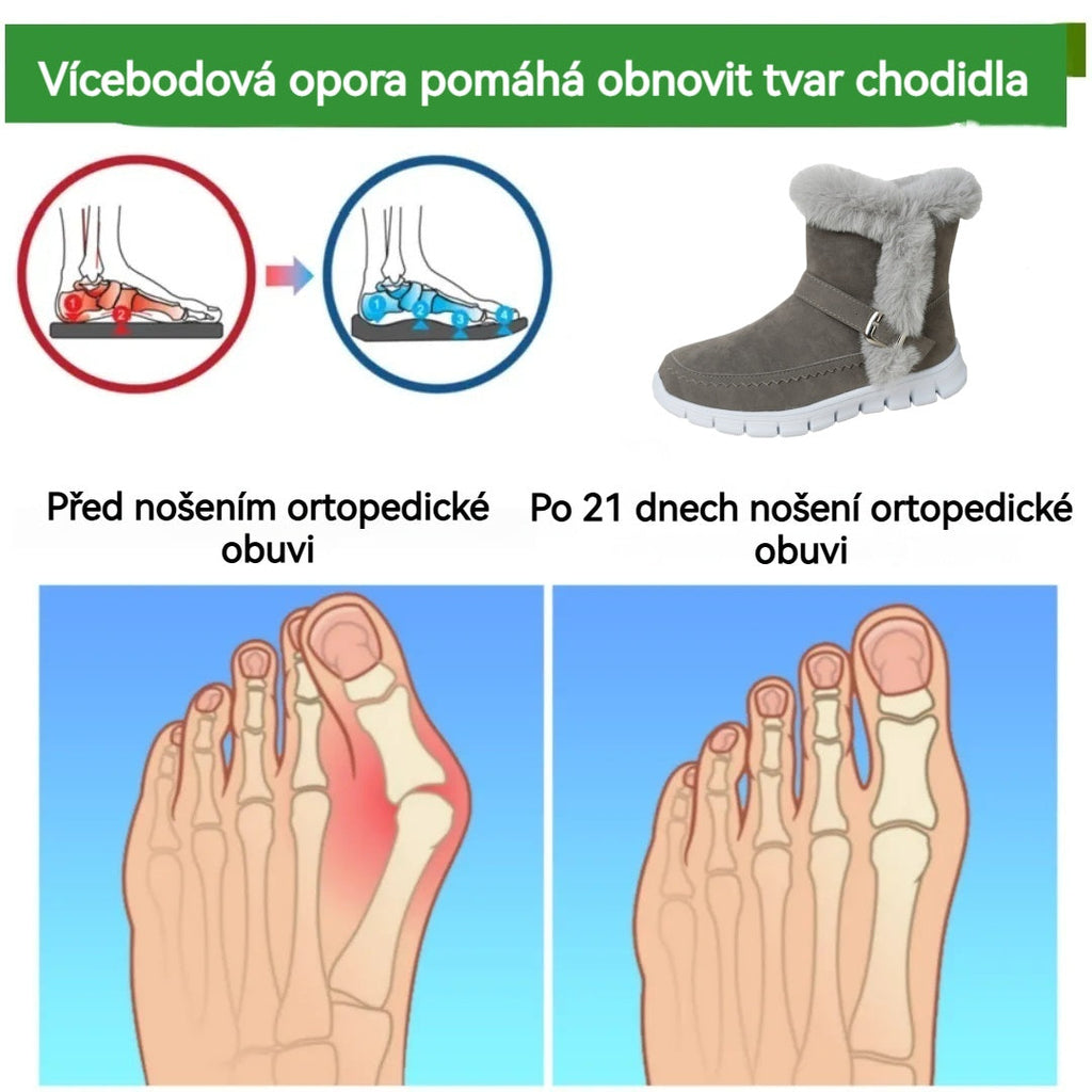 Ergonomska ortopedska zimska obuća za ublažavanje bolova u stopalima, koljenima i leđima.